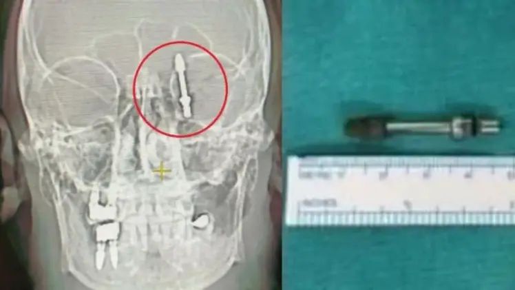 n6027105081713940188423756aa9b8bdbc7530282572a865c862642a38e4c6fd95c533dec71ef1f14a4760