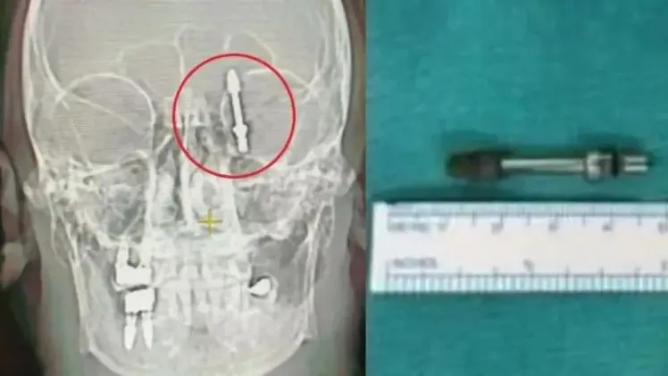 n6027105081713940188423756aa9b8bdbc7530282572a865c862642a38e4c6fd95c533dec71ef1f14a4760