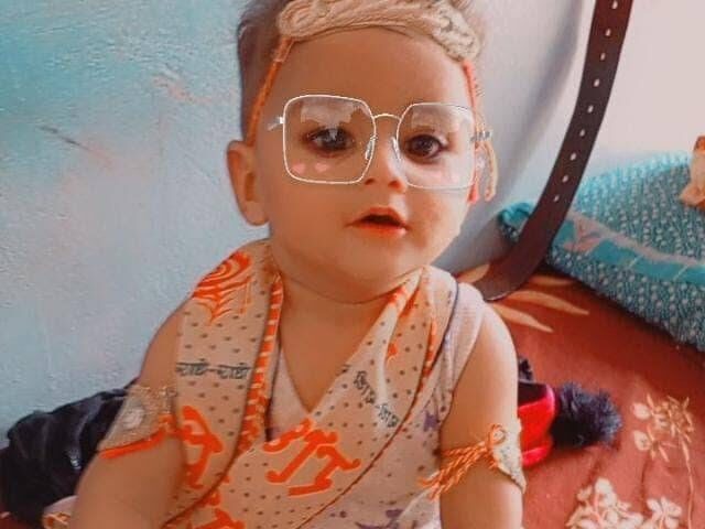 A 13 month old child fell into boiling milk, his entire body was burnt, he died two days later