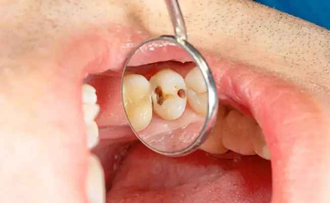 n67452687217540471483997aebccb4fc19f2d73d25459e31f1a8f6b3770ea81d5d1c92ea0c4e2186558131