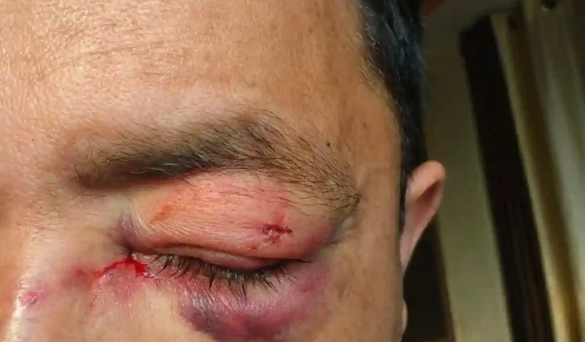 Almora: Former councilor and hotel operator Rajendra Tiwari attacked with sharp weapon