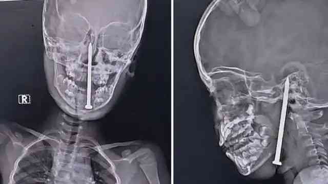 n66631988917485240432555fae55d8d2b7d8d3452905e0a3f1dcd8a524aca7997be5de1ec561be8b994730